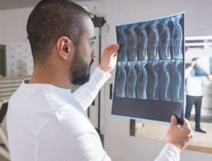 How to Treat Spinal Compression Fractures