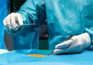 Spinal Cord Stimulator Battery Replacement Surgery