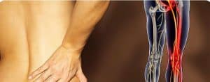 sciatic nerve block