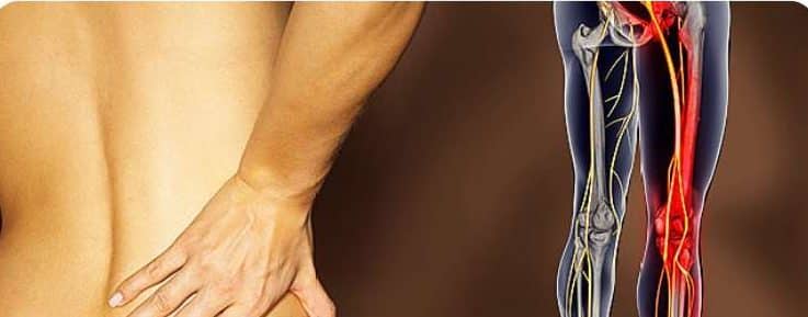 sciatic nerve block