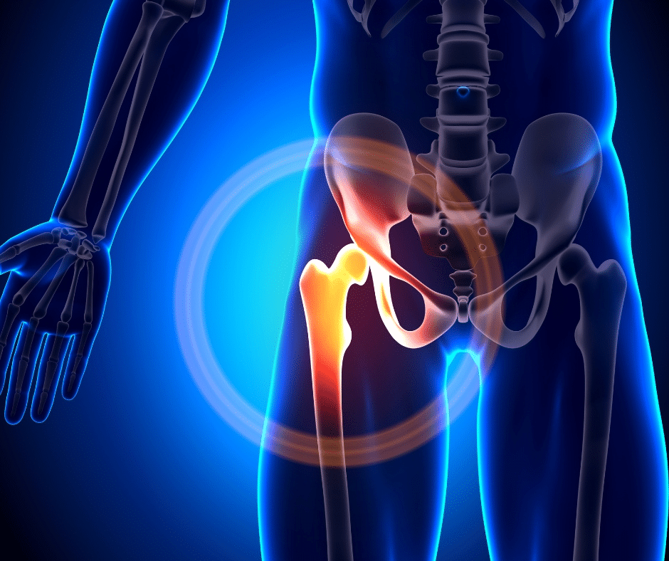 Hip Pain Relief | Explore Different Types of Hip Injections