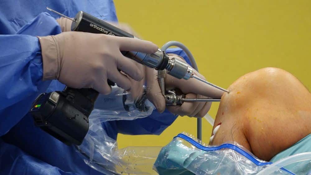 Physician preparing a stem cell injection for a patient with chronic joint pain
