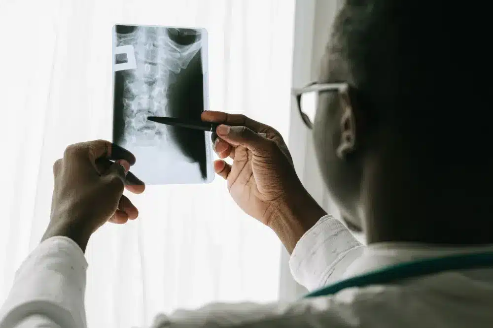 Pain specialist reviewing spine MRI scan with patient during Plano TX consultation