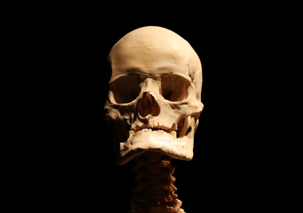 Medical diagram showing occipital nerve location at the base of the skull