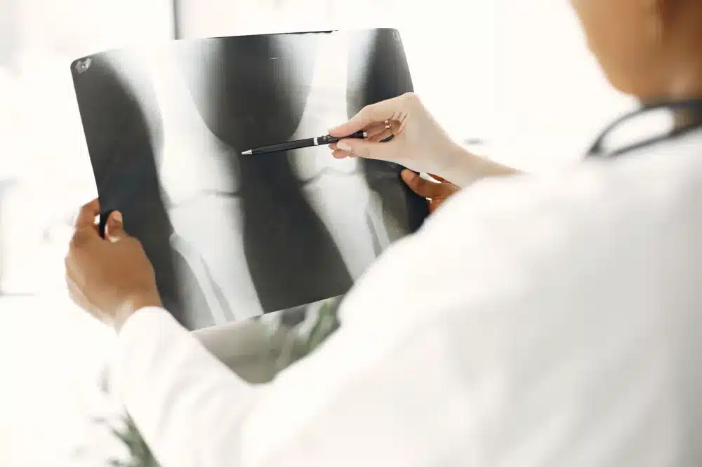 PRP Injection for Knee Osteoarthritis in Grand Prairie, TX 4 Interventional pain management doctor examining a patient's knee for osteoarthritis treatment planning