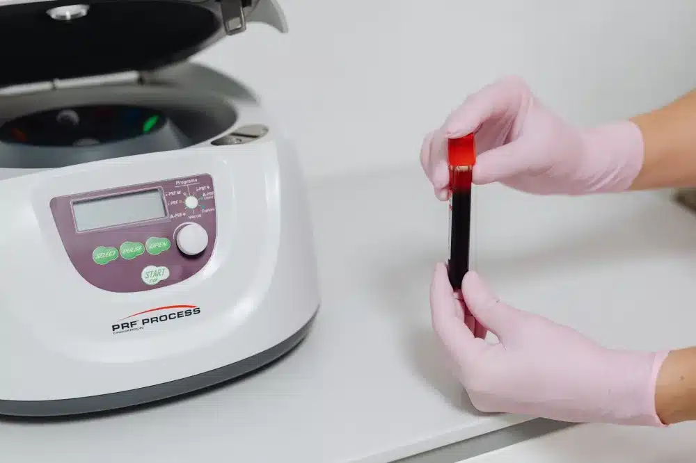 Medical technician processing blood sample in centrifuge for PRP preparation