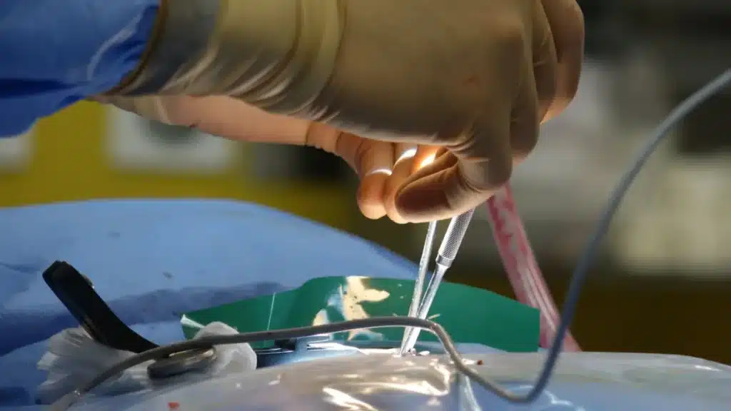 Spinal Cord Stimulation for CRPS in Plano, TX | Consult Today