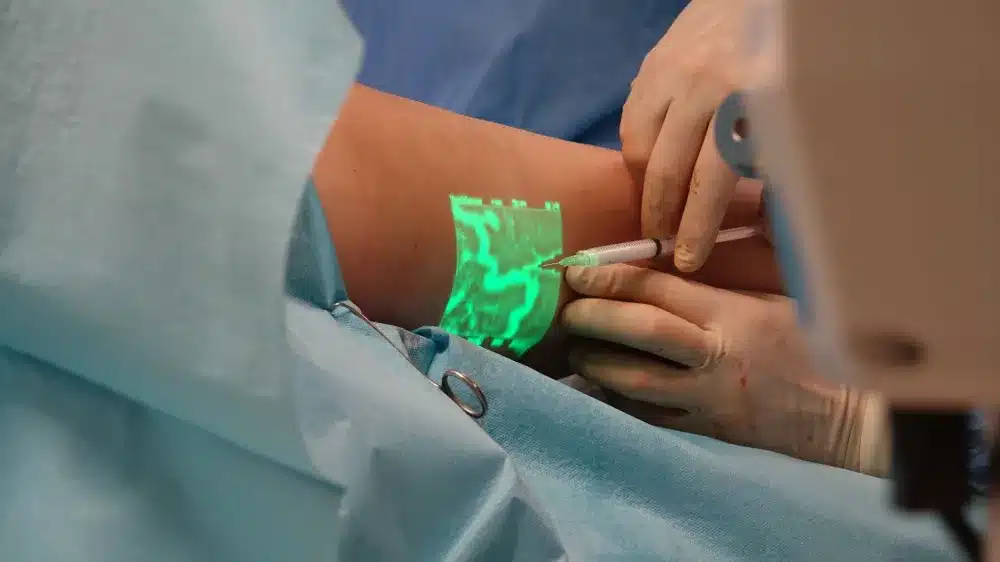 Clinician using ultrasound guidance to perform a minimally invasive trigger point injection